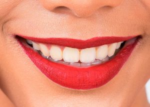 clinica-murcia-tratamiento-ortodoncia-www.clinicamasbermejo.com