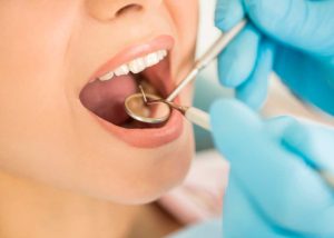 clinica-murcia-tratamiento-periodoncia-facial-www.clinicamasbermejo.com