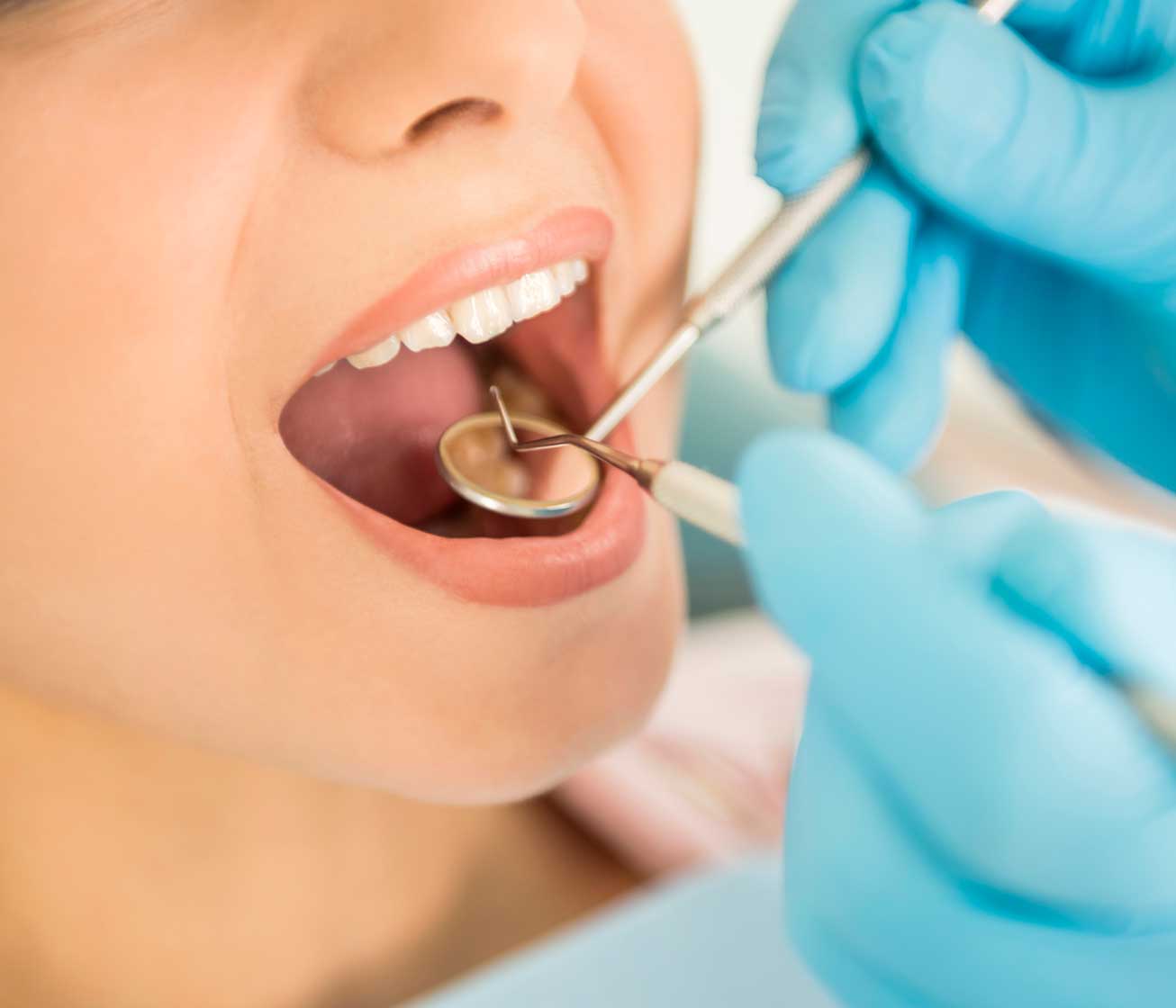 clinica-murcia-tratamiento-periodoncia-facial-www.clinicamasbermejo.com