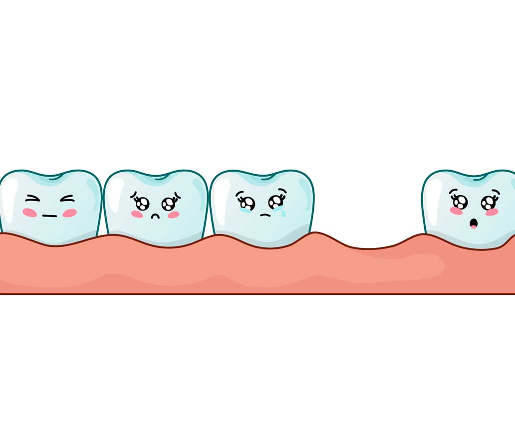 noticia-blog-perdida-dental-www.clinicamasbermejo.com