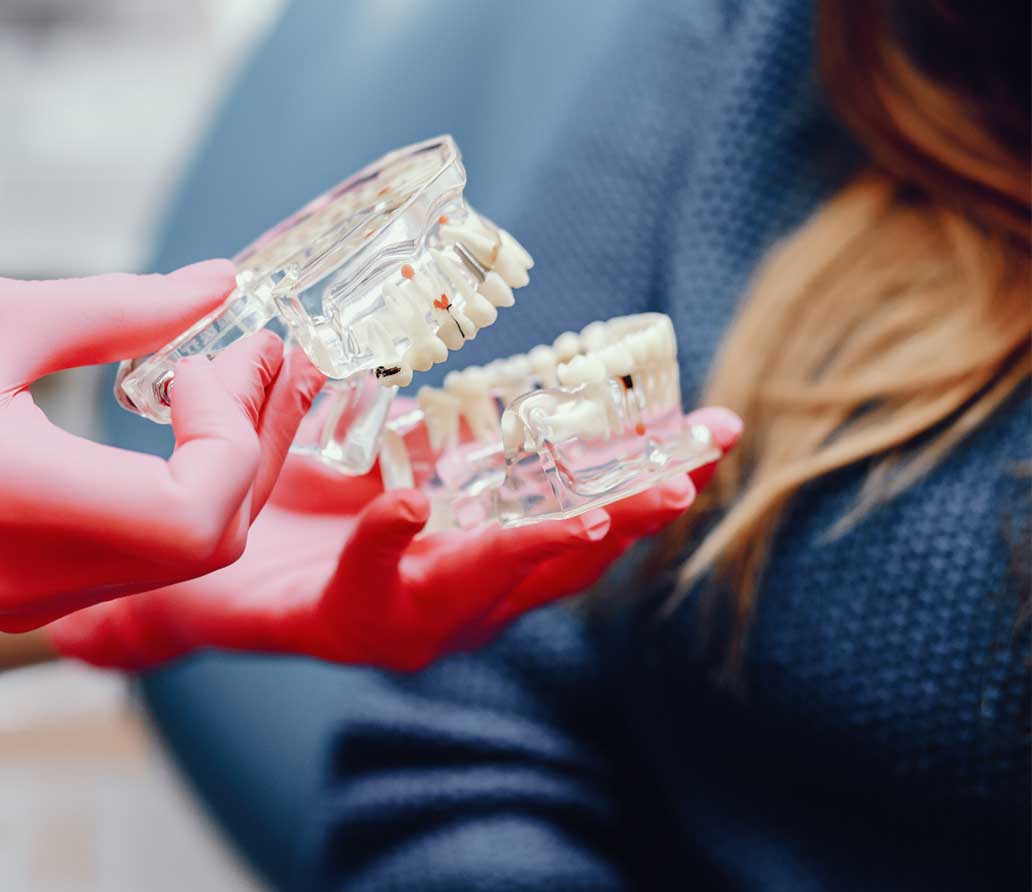 salud-implantes-blog-clinica-dental-mas-bermejo-murcia