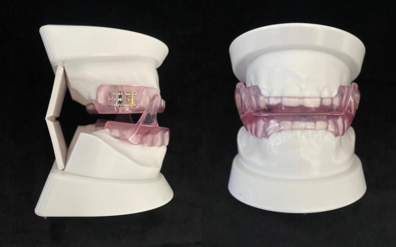 Medicina Dental del Sueño (Apnea y Ronquido)